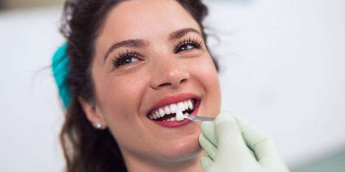 The Importance of Professional Guidance on Oral Hygiene
