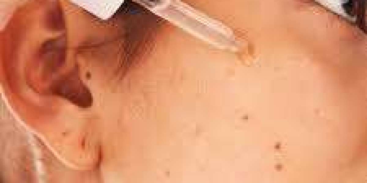 Anti-Acne Cosmetics Market report explores competitive benchmarking, investment opportunities, and global revenue growth