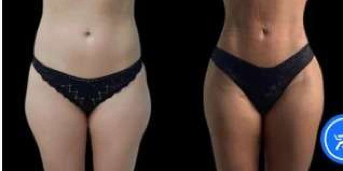 Best Aesthetic Clinics in Dubai Offering Non-Invasive Procedures – Perfectdrs