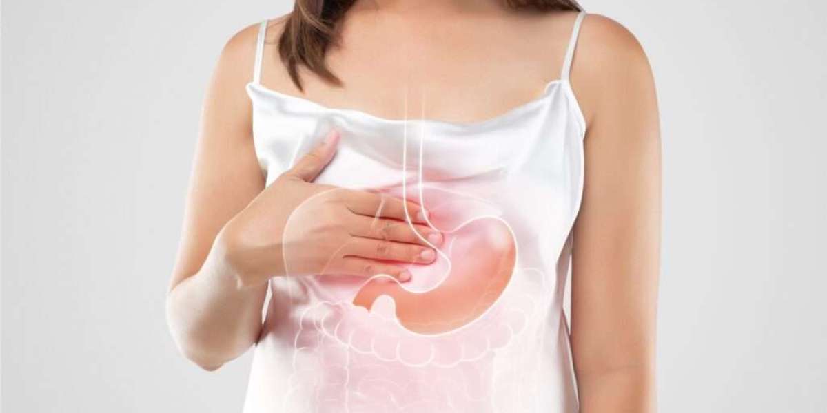Simple Lifestyle Changes to Manage Gastroesophageal Reflux Disease
