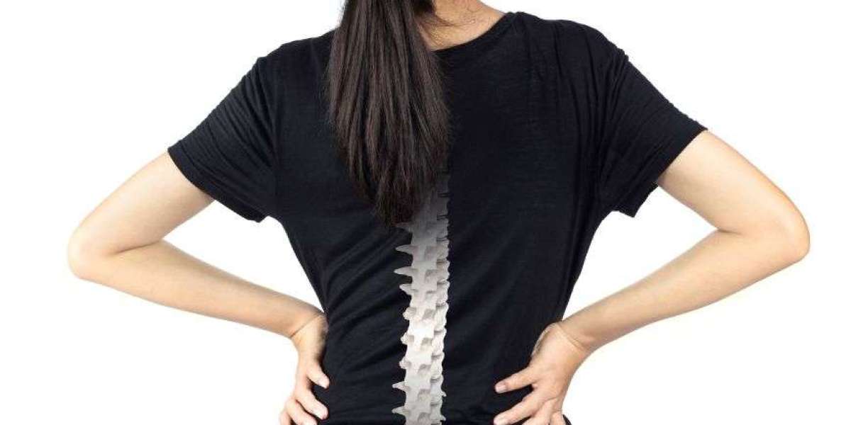 How Bone Cement Patents Are Shaping the Future of Orthopedic Treatments