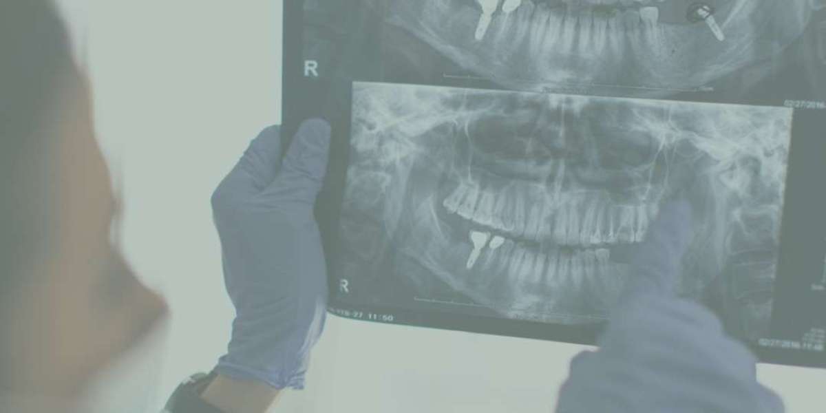 ? Dental Hygiene Pinner – Professional Cleaning & Gum Care at Pinner Dental Practice