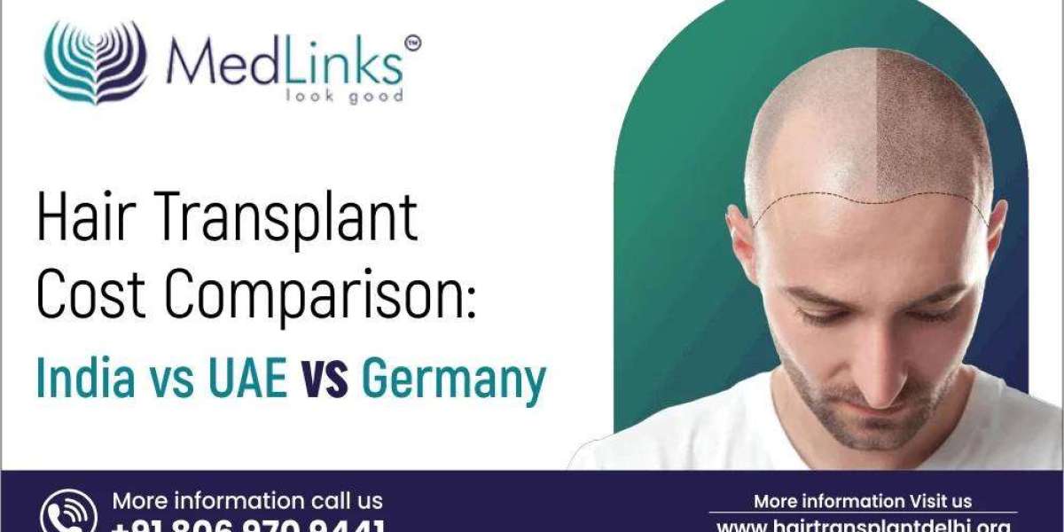 Hair Transplant Cost Comparison: India vs UAE vs Germany