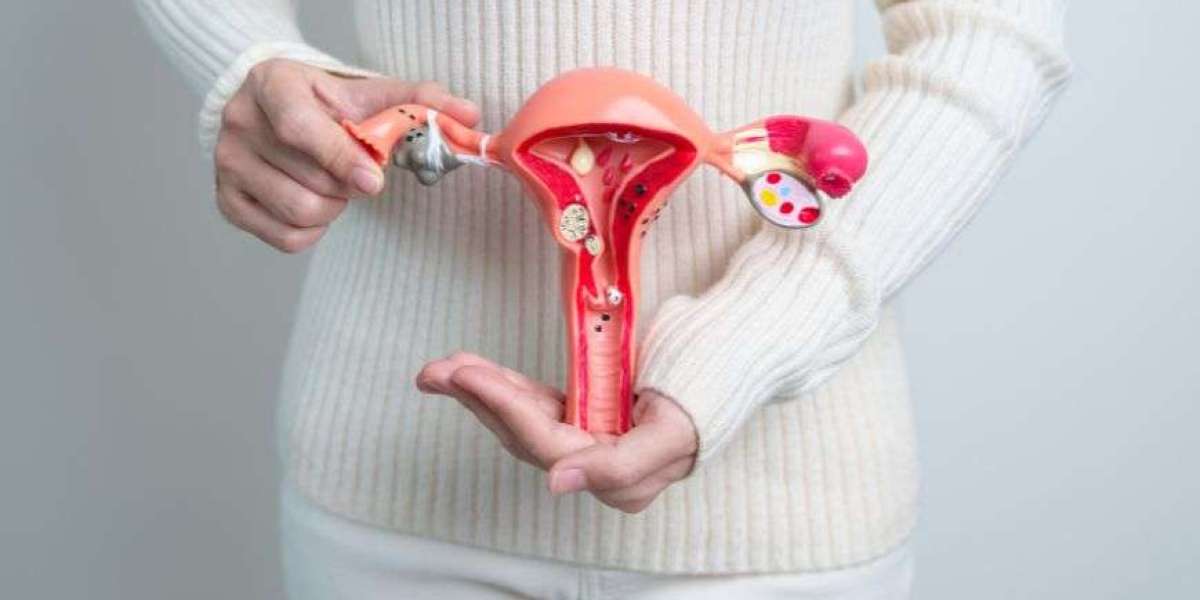 Advanced Ovarian Cancer Market: Understanding Innovation, Value, and Future Prospects