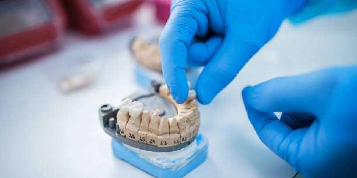 Budget-Friendly Options for Permanent Tooth Replacement