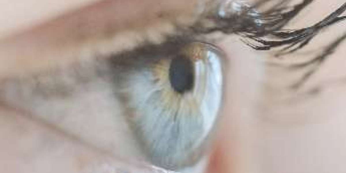 Your Trusted Partner for Cataract Surgery in Texas: Hill Country Eye Center