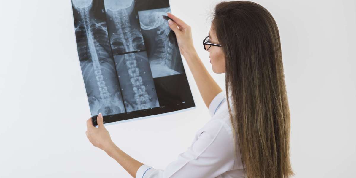 MRI LS Spine Cost in Bangalore