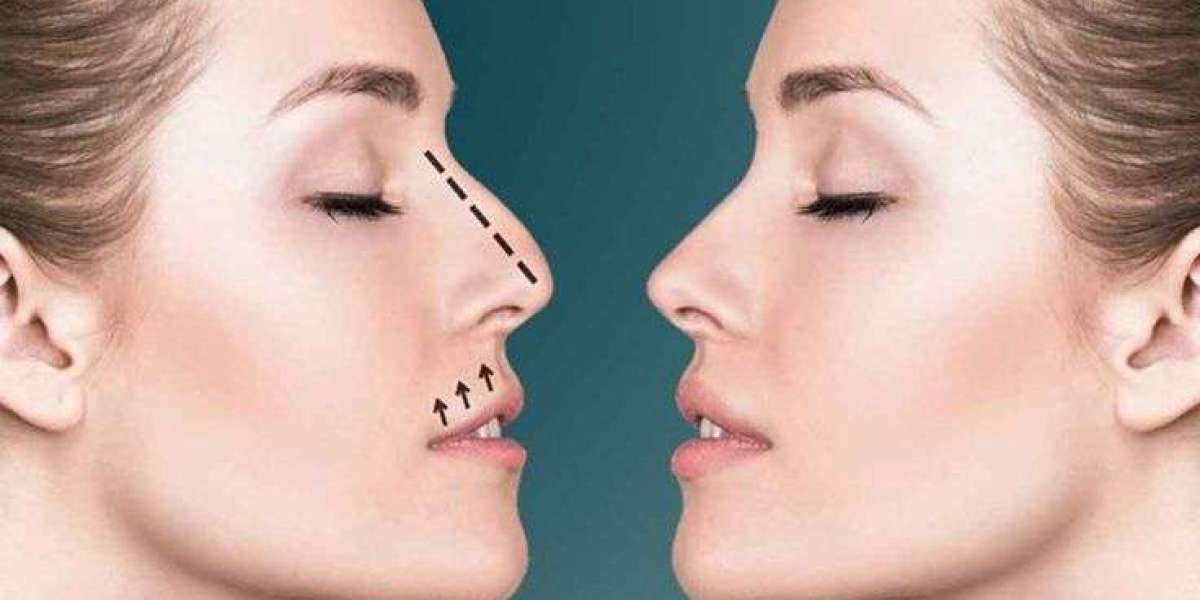 Your Guide to Finding the Best Rhinoplasty Surgeon in Lahore