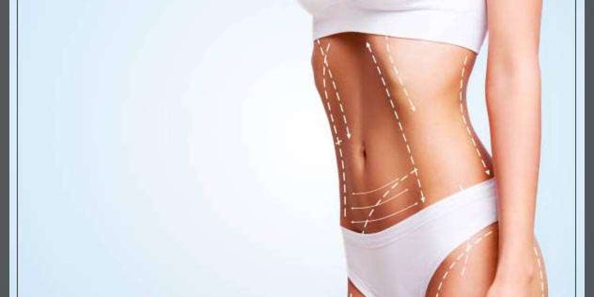 Traits That Define the Best Tummy Tuck Surgeon in Dubai