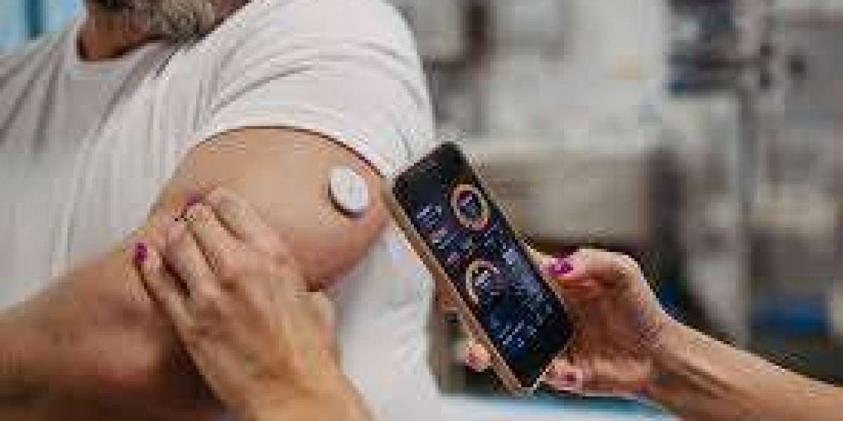 Glucose Sensors Market Trends Revolutionizing Diabetes Care Through Smart Wearable Devices Globally