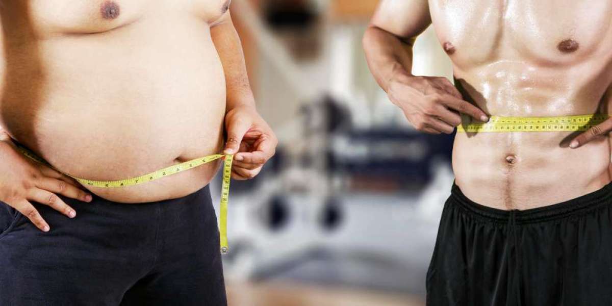 Surgical Options for Severe Obesity Treatment in Dubai