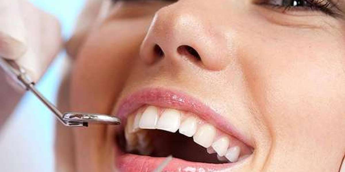 Root Canal Removal in Odessa: A Comprehensive Guide to Safe and Effective Treatment