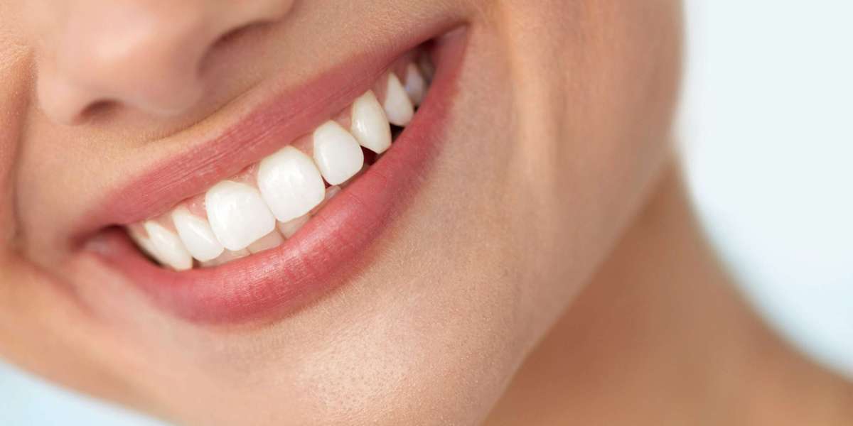The Ultimate Guide to Restoring Teeth with Tooth Crown Dubai