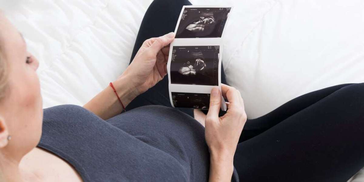 Why Expecting Parents Are Raving About 8K Ultrasound Technology