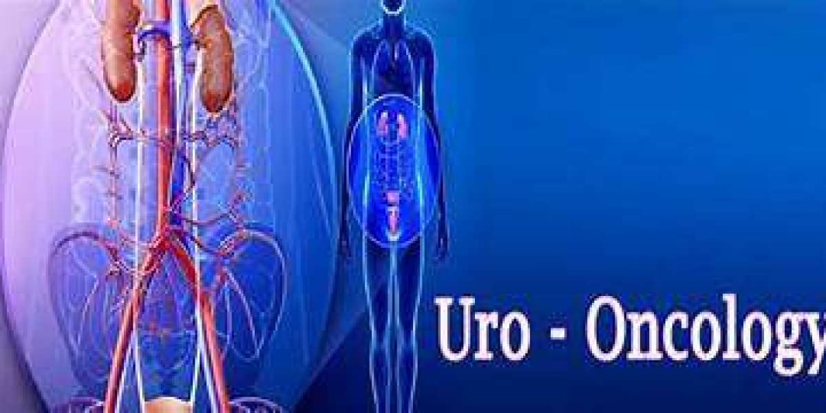 Walk-in care with best uro-oncologist in Vadodara at Sun-Pharma Road!