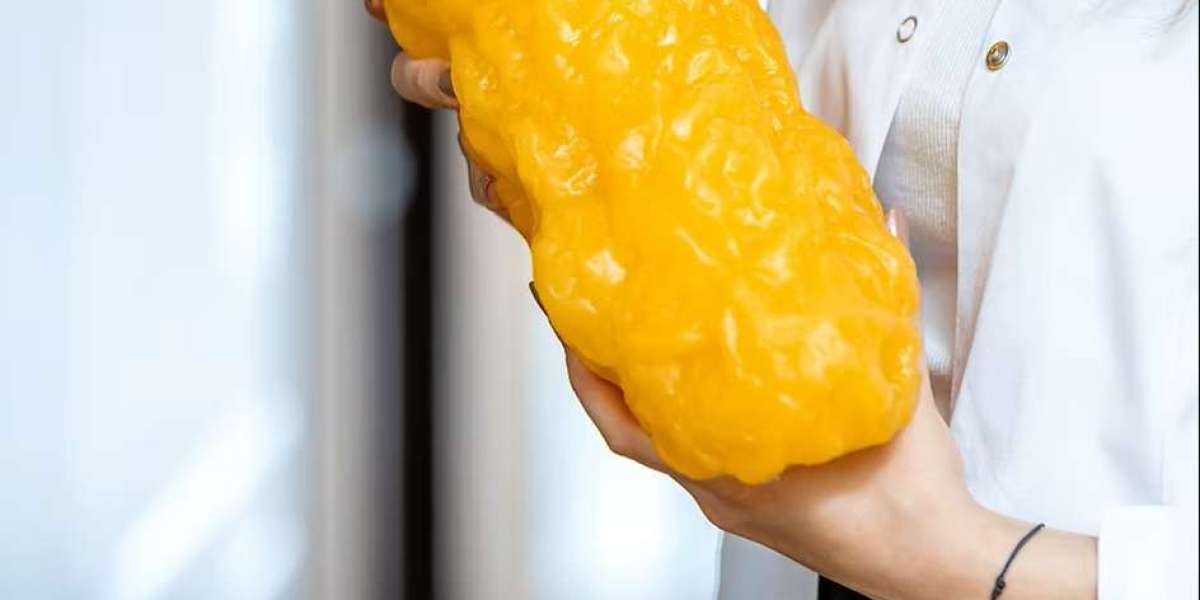 Early Signs of High Cholesterol You Should Never Ignore