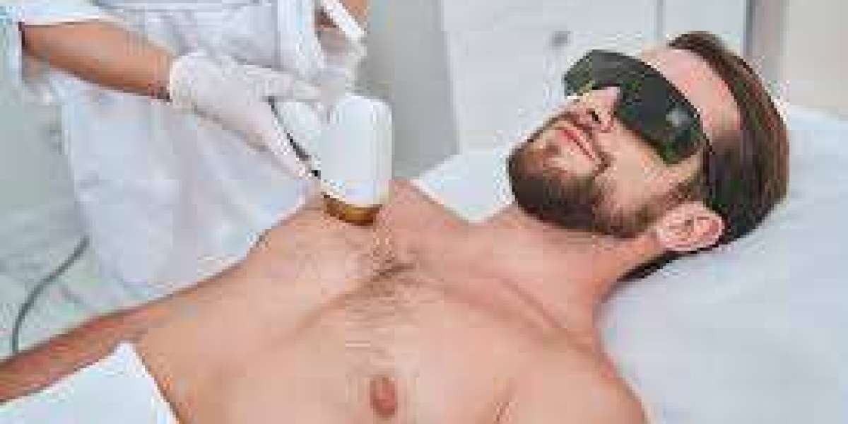 Permanent Hårfjerning Laser