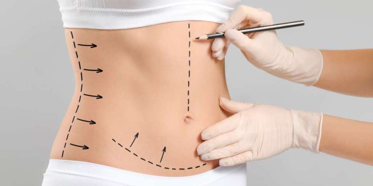 Elevate Your Confidence with a Tummy Tuck and Breast Augmentation in Dubai